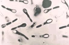 Enteric Clostridia C. perfringens: general Formerly called C.