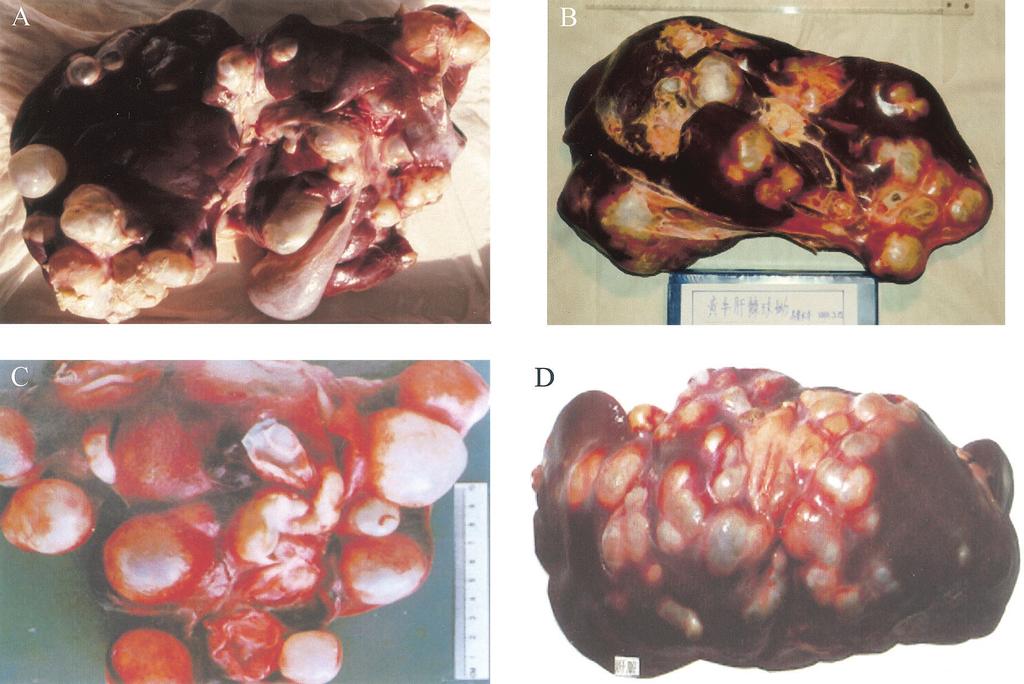 VOL. 16, 2003 IMMUNOLOGY AND DIAGNOSIS OF HYDATID DISEASE 21 FIG. 3. Cystic hydatid disease in the livers of various intermediate hosts. (A) sheep; (B) cow; (C) camel; (D) yak. cantly (73).