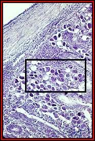 A histological section showing the asexual reproductive