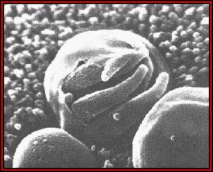 A scanning electron micrograph of a