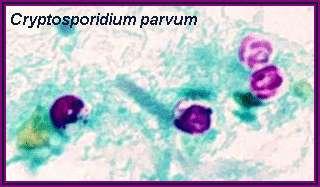 When stained using an acidfastmethod, oocysts of Cryptosporidium