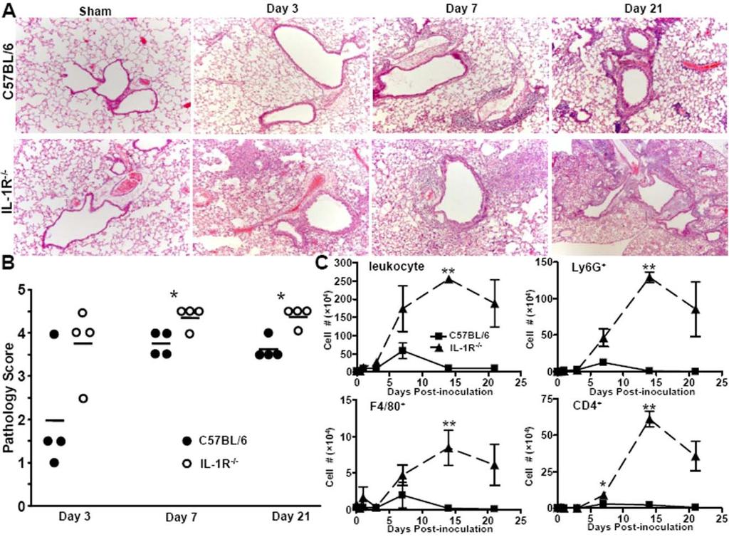 92 Figure 5.3: Increased inflammatory pathology and leukocyte recruitment of B. pertussis-infected IL- 1R -/- mice.