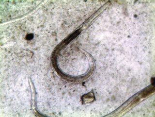 Figure 1. Photomicrograph of infective larvae of small redworms (cyathostomins).