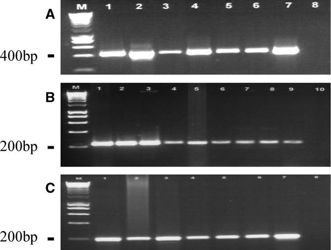 798 BOUFANA AND OTHERS Table 4 Sensitivity of Echinococcus multilocularis ND1 primers in detecting coprodna extracted from fecal samples of Chinese purged dogs and French necropsied red foxes Tibetan