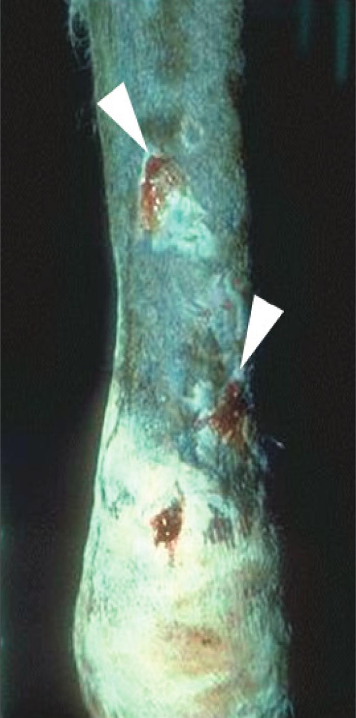 Fig. 5. Wound in Fig. 4 after 2 weeks in a cast. The tips of both flaps have sloughed (arrows), otherwise the wound has healed primarily. Fig. 6. mally has little if any benefit.