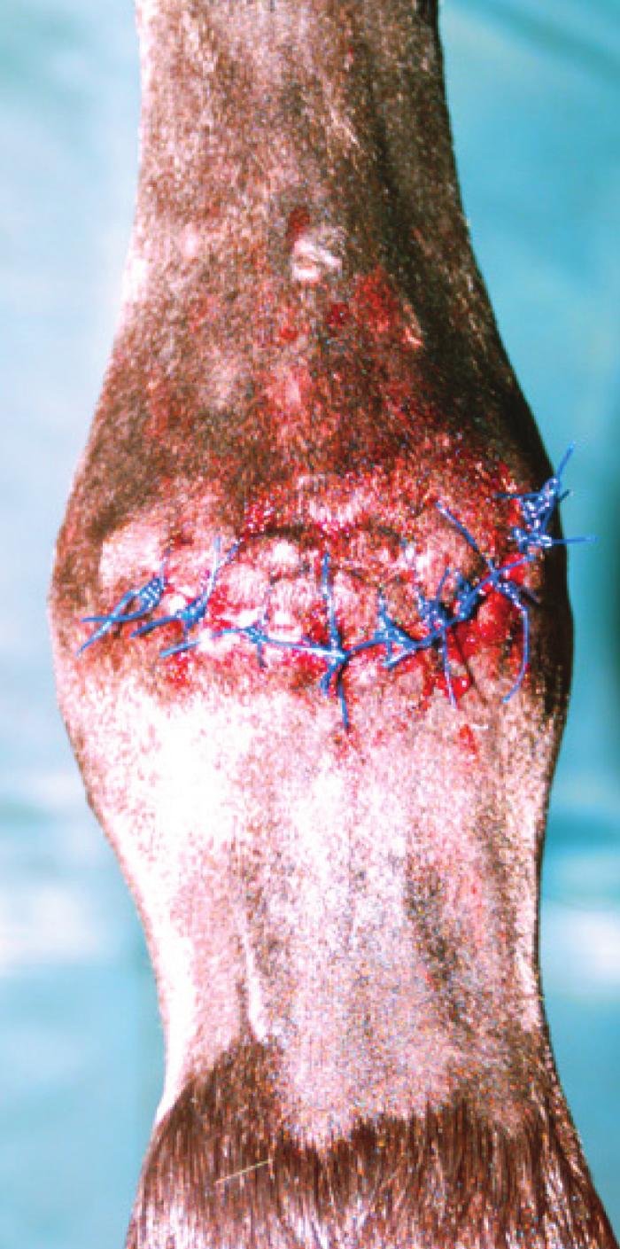 Fig. 7. Wound in Fig. 6 immediately after secondary closure. high risk of infection and dehiscence.