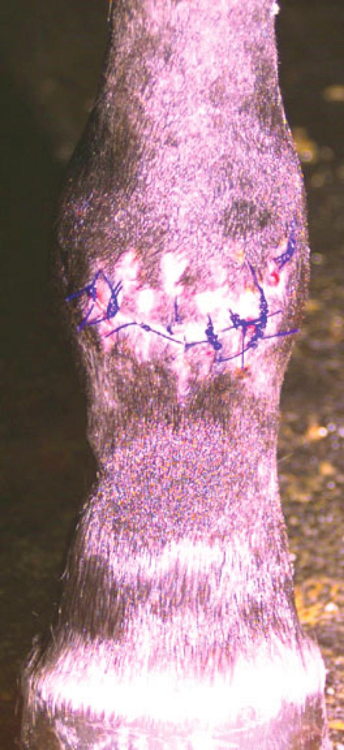 4 Leaving a fresh, highly contaminated wound open for a few days before closure allows free wound drainage and opportunity for ongoing debridement of devitalized tissues, reducing the risk of