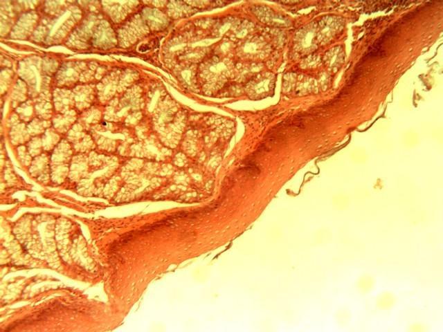 Figure 4: Photomicrograph of the caudal part of the palate; showing non-keratinized stratified squamous epithelium (), dense connective tissue (), glandular units () and lymphoid follicles ().