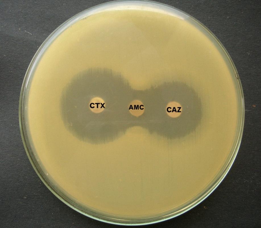 Figure II ESBL producer by DDST method with presence of Amoxycillin / clavulanic acid (AMC) at the centre with cefotaxime (CTX) and Ceftazidime (CAZ) on either side showing potentiation towards AMC