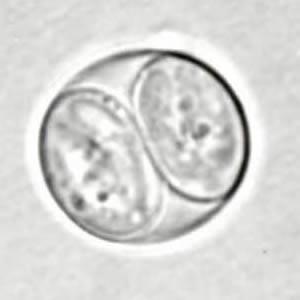 Tachyzoites, 6 x 2 µm: during acute stage of infection Bradyzoites,