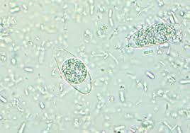 Cystoisospora belli Fresh faecal smear Only in human and primate Asexual and sexual
