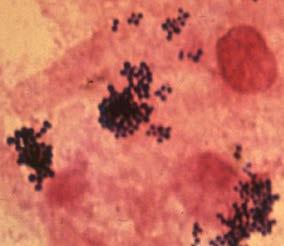 S. aureus Microbiology Gram-positive cocci Grape-like clusters on gram