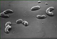 Cholera bacteria Throw net