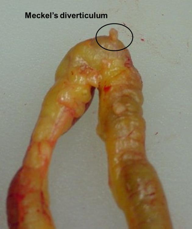 Fig. 6. Location of the Meckel's diverticulum in the digestive tract of a chicken. Source: Jacquie Jacob, University of Kentucky.