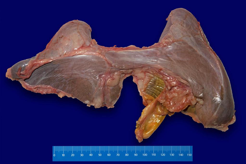2: A & B- Dorsal view of the right (R) and left (L) liver