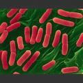 ESBL and CRE ESBL: Extended-Spectrum Beta Lactamase-Producing gram-negative bacteria CRE: Carbapenem Resistant Enterobacteriaceae Cause variety of infections: Pneumonia