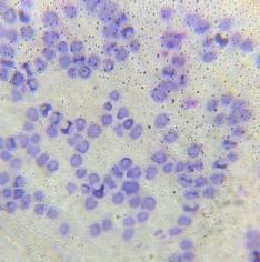 Theileriosis is one of the most important arthropod-borne blood protozoan diseases, leading to morbidity and mortality especially in calves, which are commonly