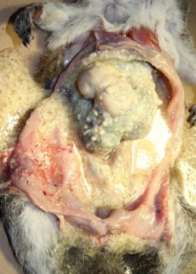 cystic masses often coalesced and adhered to visceral