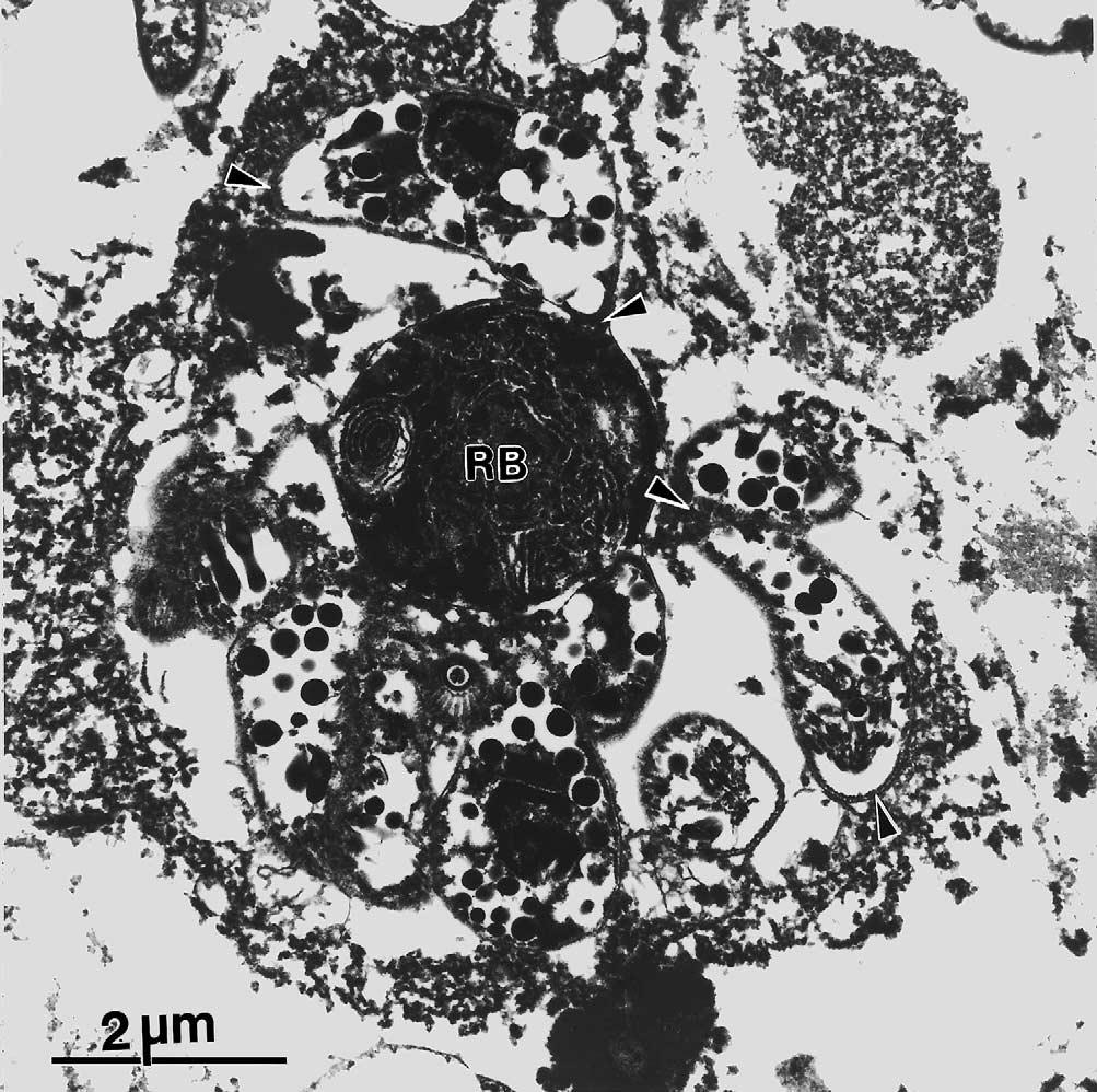 56 J.P. Dubey et al. / Veterinary Parasitology 116 (2003) 51 59 Fig. 4. Transmission electron micrograph of a group of protozoa (arrowheads) arranged around a prominent residual body (RB).