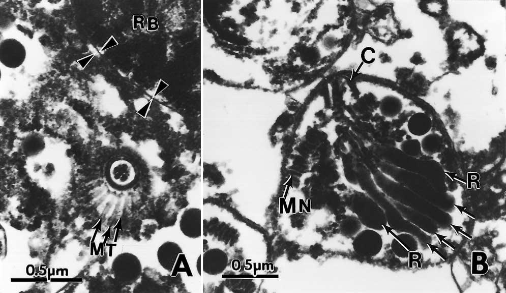 J.P. Dubey et al. / Veterinary Parasitology 116 (2003) 51 59 57 Fig. 5. Transmission electron micrograph of two zoites.