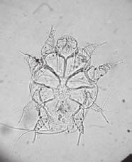 All legs of the male mites had long unjointed pedicels with suckers. Their legs were longer than those of female mites.
