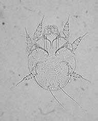 Larva had three pairs of legs with distinct epimeres. Chitinized bars and transverse striae were found on dorsum of idiosoma. Dorsal scale was not found on idiosoma of larvae.