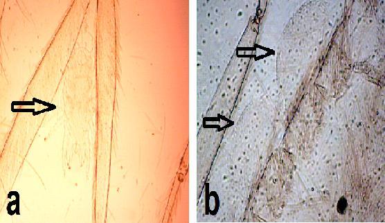 mite from Iran. Several reports from different parts of the world provide this evidence that the Eustigmaeus-sand fly association is not accidental (Zhang and Gerson 1995).