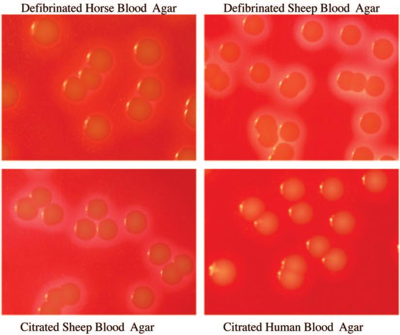 VOL. 44, 2006 CITRATED SHEEP AND HUMAN BLOOD AGAR 3349 FIG. 2. Growth of S. aureus ATCC 25923 on the four different blood agars at a dilution of 1 10 2 CFU/ml. HuBA (Table 2; Fig. 1).