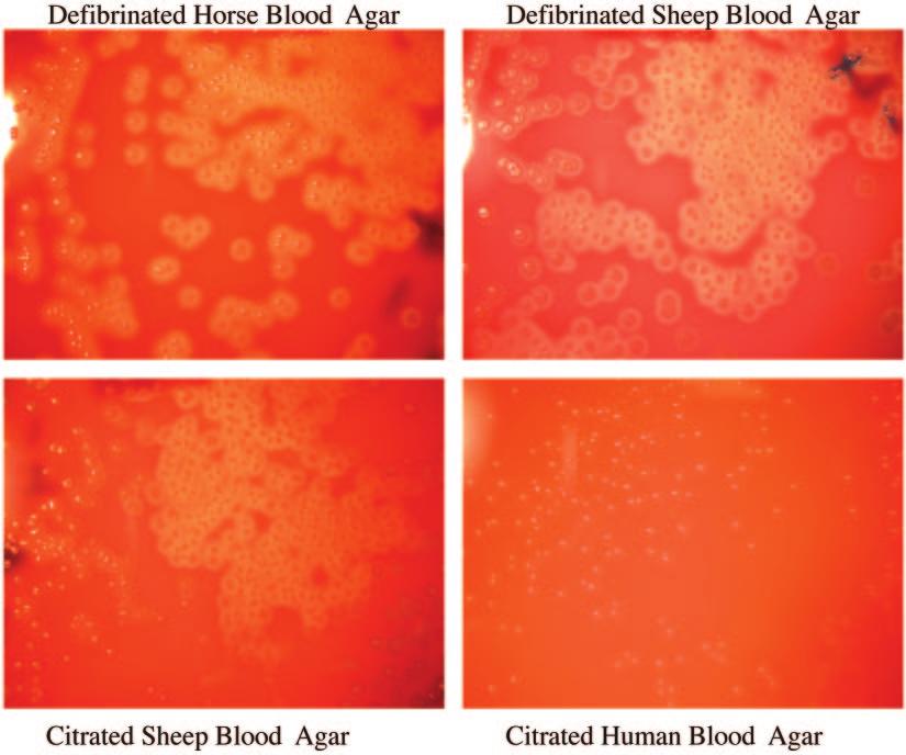 3350 RUSSELL ET AL. J. CLIN. MICROBIOL. FIG. 3. Growth of Streptococcus pyogenes ATCC 19615 on the four different blood agars at a dilution of 1 10 2 CFU/ml. S. pneumoniae strain and medium human blood is commonly used as a medium supplement.