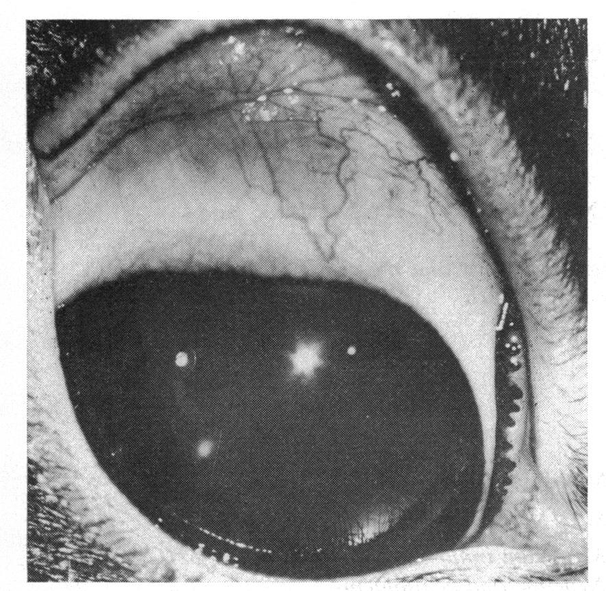N. * o S j. r A.! 1, Ḷ 6 British ournal of Ophthalmology _5 FG. Rabbit eye after days of saline injections s.:..e$... length with sufficient pressure to penetrate the superficial corneal stroma.