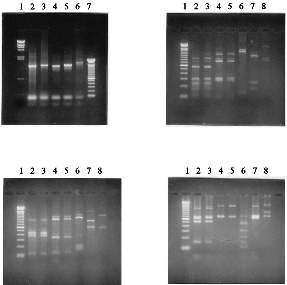 136 MAYTA ET AL. J. CLIN. MICROBIOL. FIG. 3. PCR-amplified fragments and enzyme restriction patterns. (Upper left) PCR-amplified fragments obtained by using DNA templates from T. solium (lane 2), T.