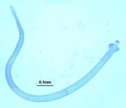 Adult worms cm, with small rounded scolex at 0.7X 1.5-4 Small.anterior end & proglottids at posterior wider end.