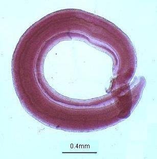 S. haematobium