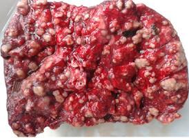 No. of carcass screened: 1235 Carcass with