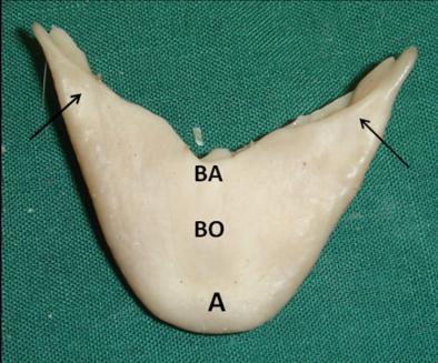 4: Pharyngeal cavity of ostrich: L) larynx. P) roof of pharynx with pharyngeal tonsil (*). TR) trachea. ML) mucosal laminae Fig.