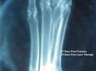Non-Union Fracture Greg Hayes, DVM Patient / Condition Ursa, Rotweiler Non-healing fracture (48 days) K-Laser