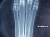 ..the laser was used over a non-healing fractured metatarsal on an older Rottweiler.