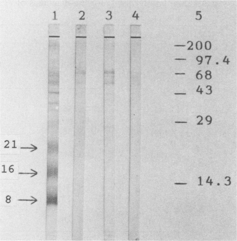 pool of sera from five surgically confirmed hydatid patients; lane 2, serum sample from a patient with cysticercosis; lane 3, serum sample from a patient with H.