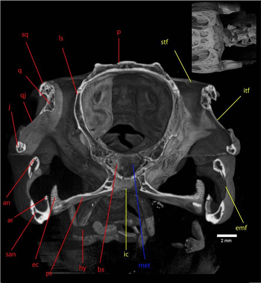 Figure 11: Coronal section through supratemporal fenestrae. Upper right picture shows the location of the cut.