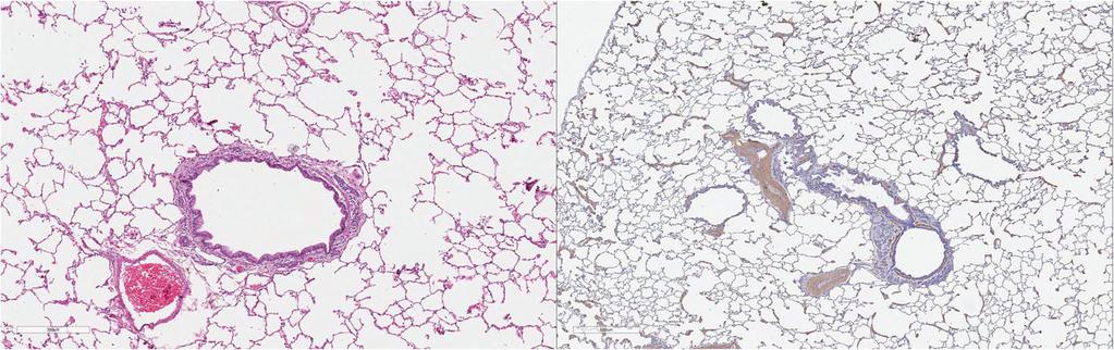 The Author(s) Parasites & Vectors 2017, 10(Suppl 2):514 Page 220 of 11 Fig. 22 a (left) and b (right). Histopathology of feline lung with H & E stain or alpha-smooth muscle actin stain after L3 D.