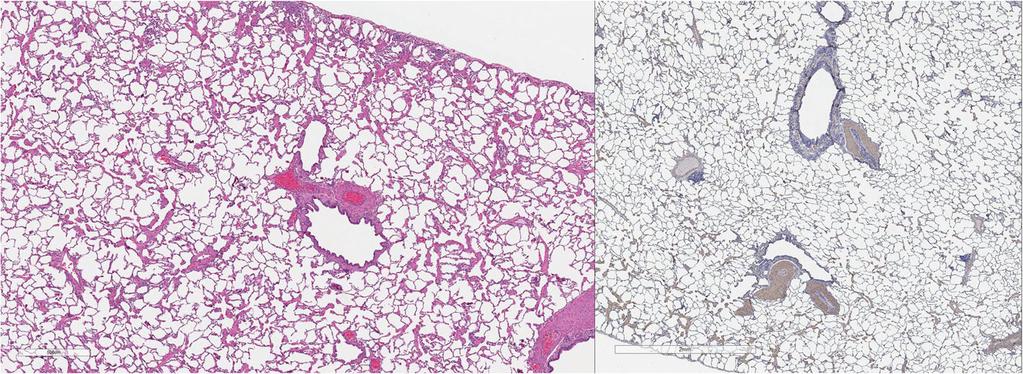 The Author(s) Parasites & Vectors 2017, 10(Suppl 2):514 Page 221 of 11 Fig. 24 a (left) and b (right). Histopathology of feline lung with H & E stain or alpha-smooth muscle actin stain after L3 D.