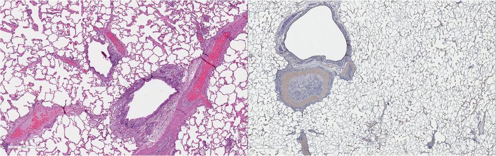 The Author(s) Parasites & Vectors 2017, 10(Suppl 2):514 Page 222 of 11 Fig. 26 a (left) and b (right). Histopathology of feline lung with H & E stain or alpha-smooth muscle actin stain after L3 D.