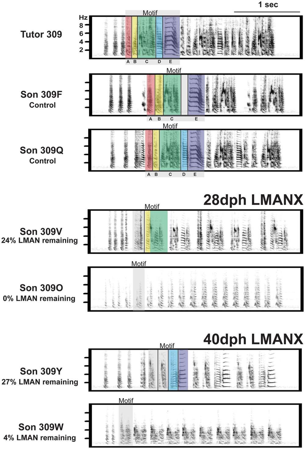 Basal Ganglia and Vocal Development 583 Figure 7 LMAN ablation at 28- or 40-dph impairs accuracy, duration and amplitude of tutor song imitation.
