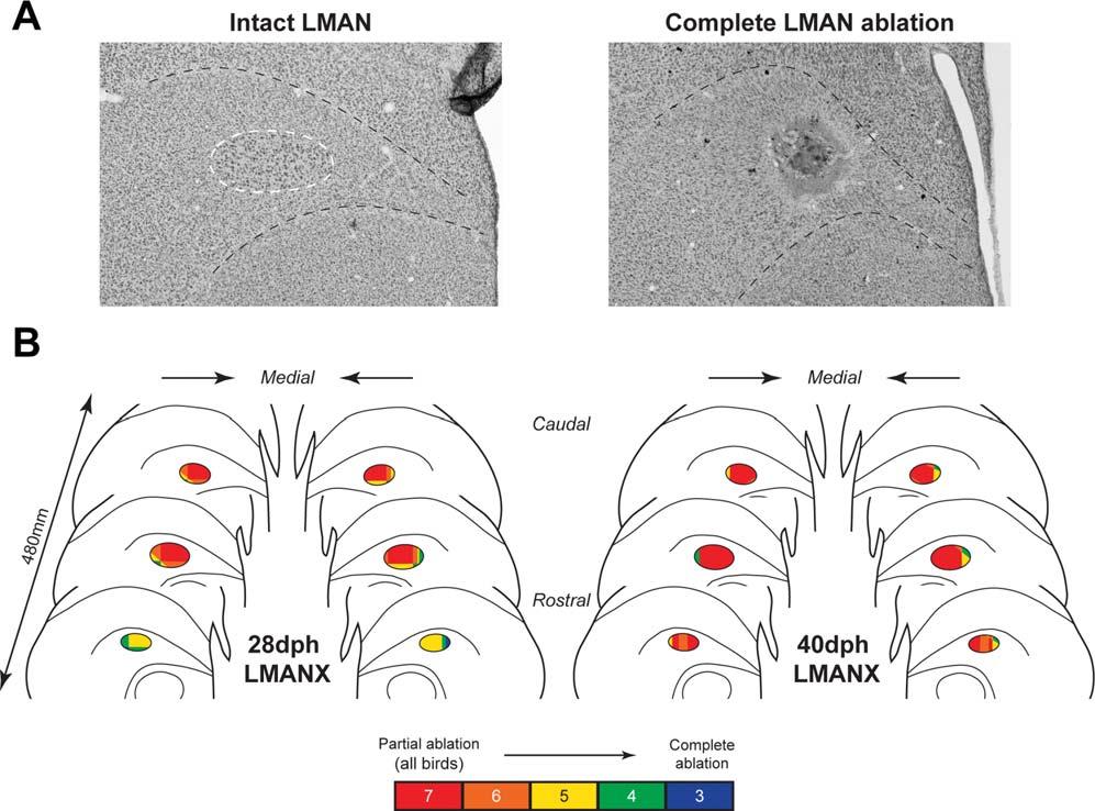 580 Elliott et al. Figure 3 Overlay of bilateral coronal sections in both LMAN-ablation groups.