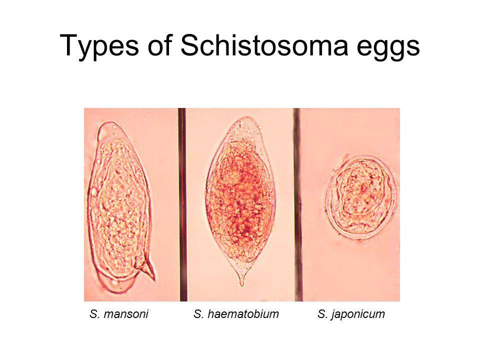 Diagnosis is by O&P: S mansoni (lateral spine) egg in stool S japonicum