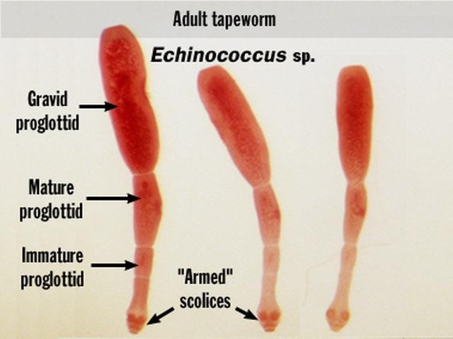 Echinococcus granulosus (hydatid cyst) Echinococcus granulosus is a small,