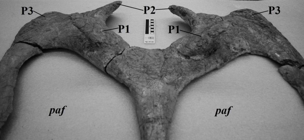 pa/ pa/ Fig. 18. Oblique view of posterior parietal U-shaped keyhole. Scale bar is 10 cm. (Photo by J.
