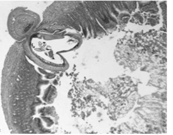 142 Korean J Parasitol. Vol. 48, No. 2: 139-143, June 2010 A B C Fig. 3. Section of the intestine and abdominal muscle of a rat. (A) A larva is penetrating the intestinal wall on day 1 PI.