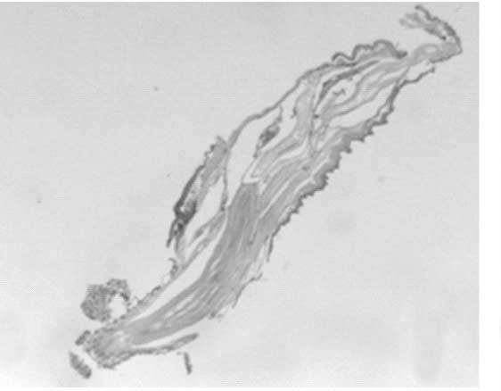 (B) Section of a 15- day old male, showing 3 tubular structures of cement glands. The testes are also seen anteroventrally. Bar = 200 mm.