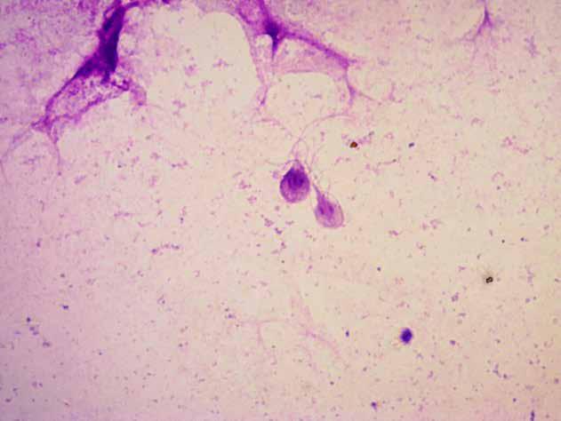 Tritrichomonas and Giardia in a diarrhoic cat Giardia duodenalis is a common protozoan parasite that colonizes the small intestine of a variety of domestic and wild animals.